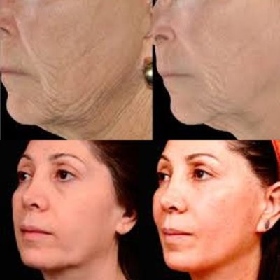 Before and after beauty and medical treatments. Before and after beauty and medical treatments.