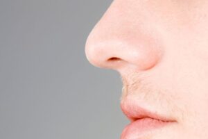 A male who just had a nose job