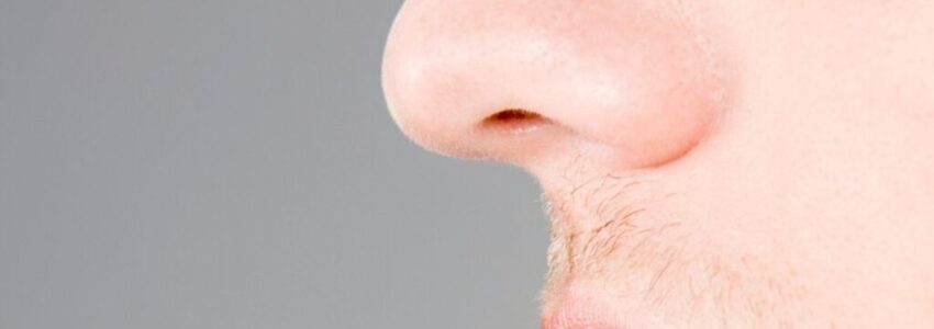 male nose job A male who just had a nose job