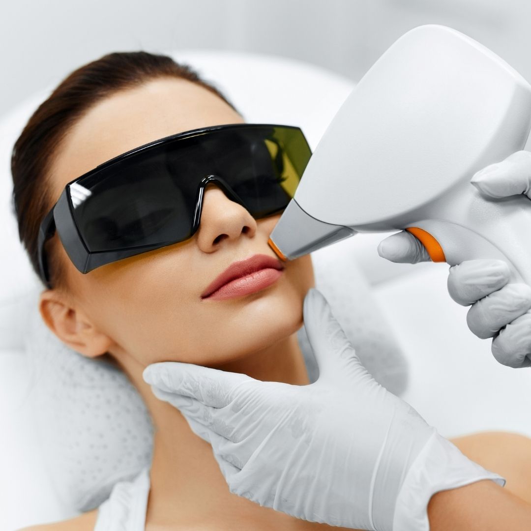 Laser hair removal on the lips.