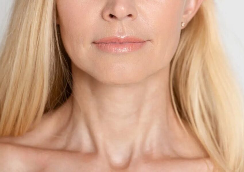 A woman showing her neck wrinkles and lines.