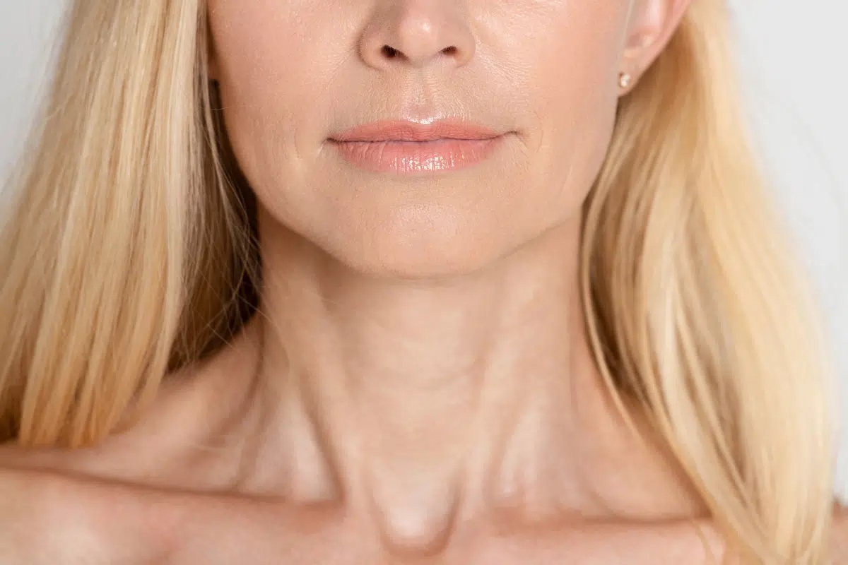 get-rid-neck-wrinkles