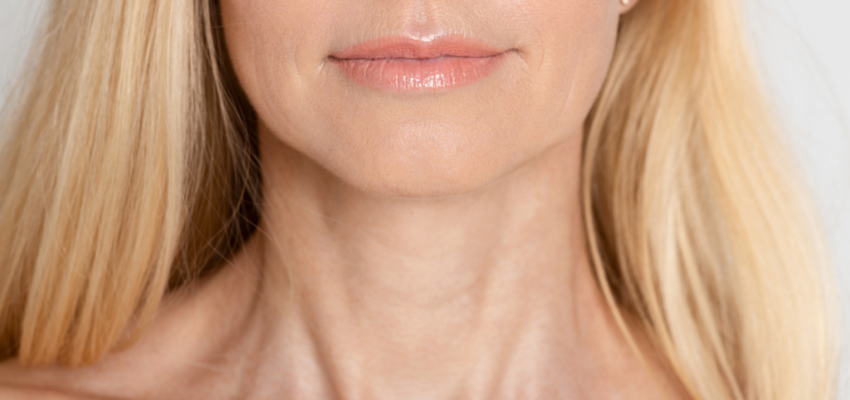 A woman showing her neck wrinkles and lines.