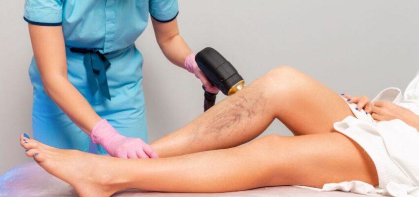 A woman got an appointment to her trusted doctor at her favorite medical spa and did her laser therapy to eliminate varicose veins.