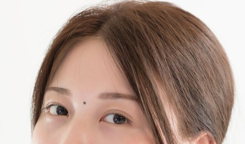 A woman was born with monolids and decided to have double eyelid surgery.