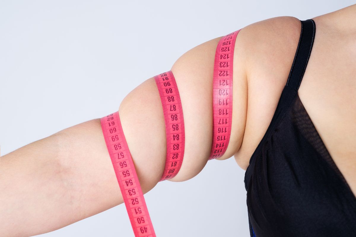 A woman who has stubborn arm fat wants to try liposuction on arm.