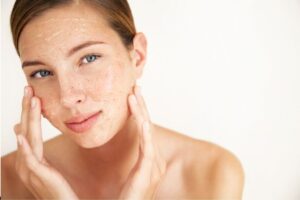 The woman has over-exfoliated skin.