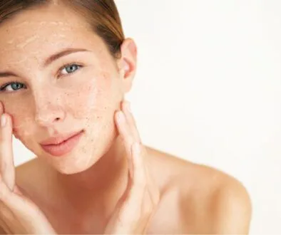 The woman has over-exfoliated skin.