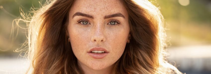 A woman putting on sunscreen to prevent freckles in her hands.