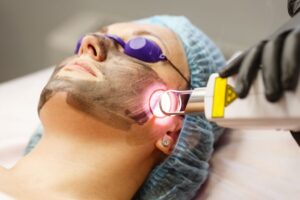 The woman decides to undergo CO2 laser after learning the benefits of CO2 laser.