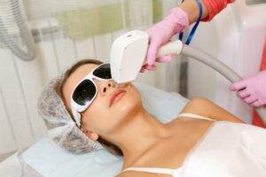 The woman tries upper lip laser hair removal.