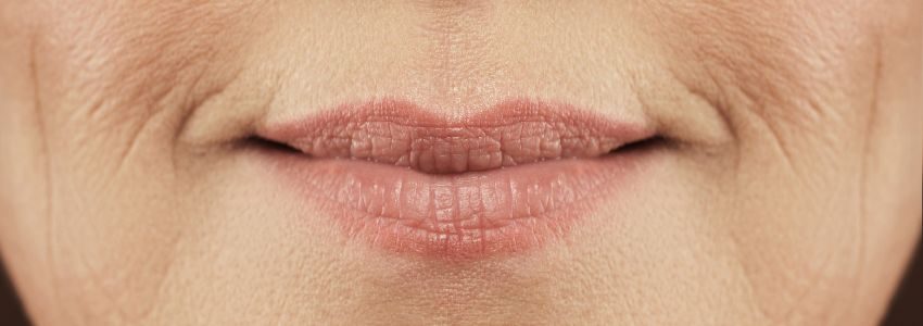 Lip wrinkles manifest on both the lips themselves and on the complexion of the upper lip.