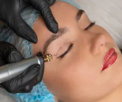 The woman tries plasma fibroblast to tighten her skin.