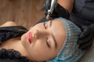 A woman going through a plasma fibroblast procedure.