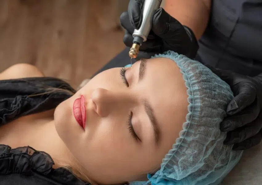 A woman going through a plasma fibroblast procedure.