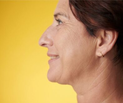 The woman has jowls.