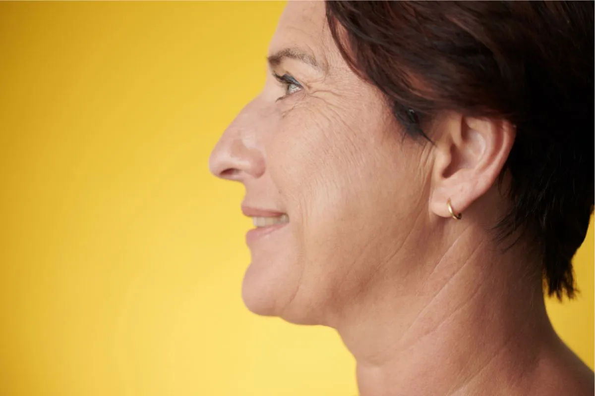 The woman has jowls.