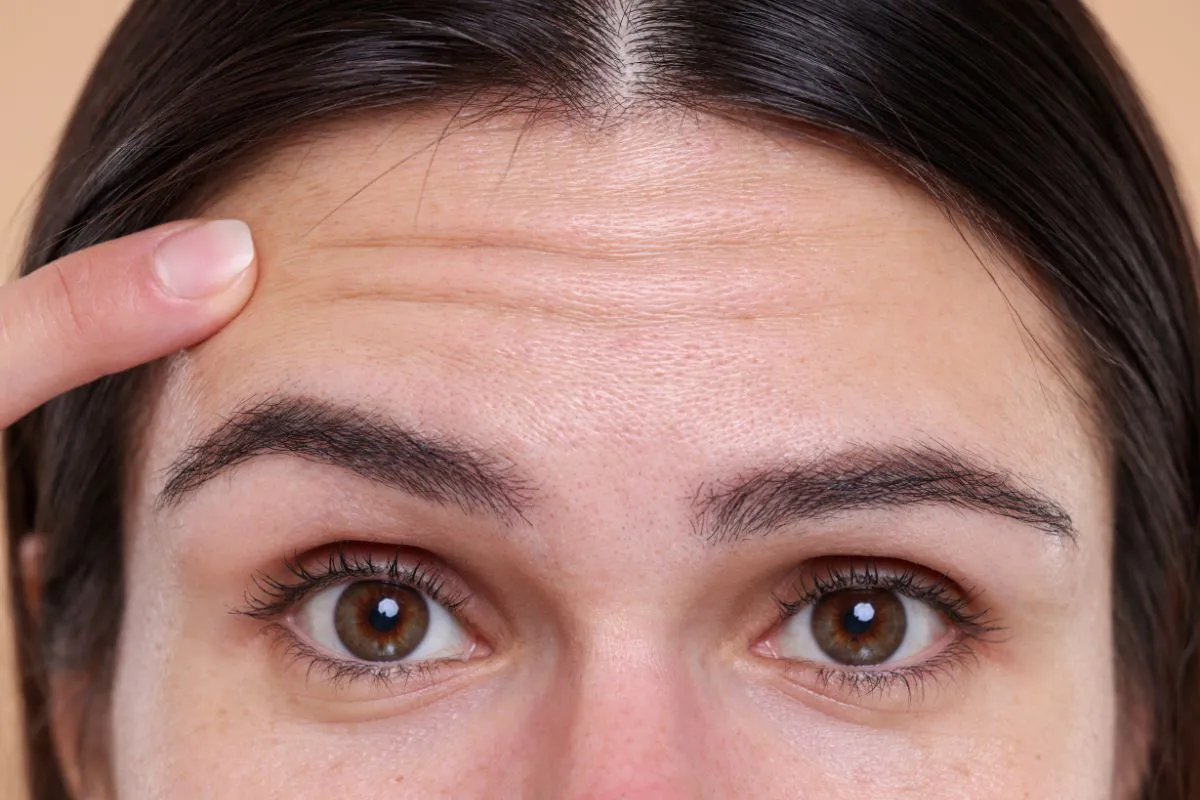 The woman has forehead wrinkles.