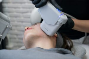 A woman undergoing several sessions of collagen boosting treatments.