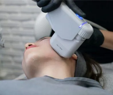 A woman undergoing several sessions of collagen boosting treatments.