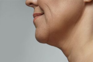 The woman has wrinkles on her neck.