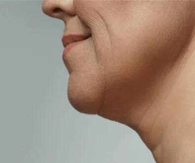 The woman has wrinkles on her neck.