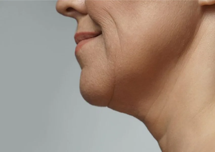 how to tighten neck skin naturally (1) The woman has wrinkles on her neck.