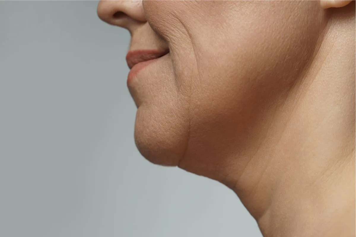 The woman has wrinkles on her neck.