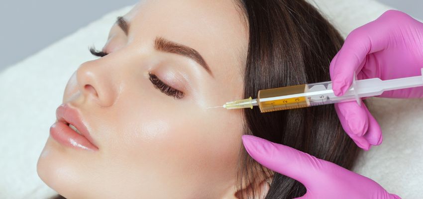 platelet-rich-fibrin3 Aesthetic procedure with platelet rich fibrin injections on a woman’s face.